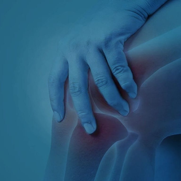 Discover the symptoms, causes, and effective treatments for knee osteoarthritis in the UK. Learn how to manage pain, improve mobility, and regain an active lifestyle.